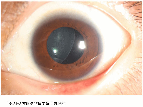 ZY016_107_4.gif